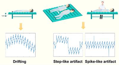 Removing Clinical Motion Artifacts During Ventilation Monitoring With Electrical Impedance Tomography: Introduction of Methodology and Validation With Simulation and Patient Data